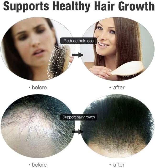2 ПЦС 300мл Шампон за задебелување на косата мажи жени длабоко скалп фоликула Анти-падна коса промовира шампон за раст на косата
